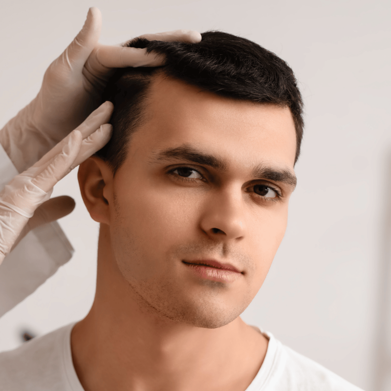 Recovery After Hair Transplant: A Step-by-Step Guide